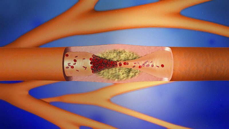 ���併�£������ȷ����������Ѫ�ܼ������߸�ע��ʲô��ר����ʾ